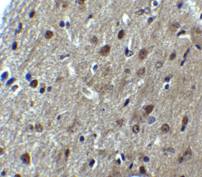 0.1MG ARID1A 0.1 MG