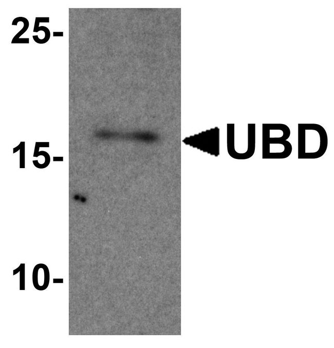 0.1MG UBD 0.1 MG