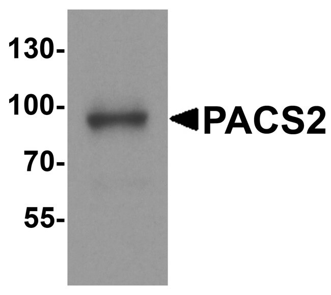 0.1MG PACS2 0.1 MG