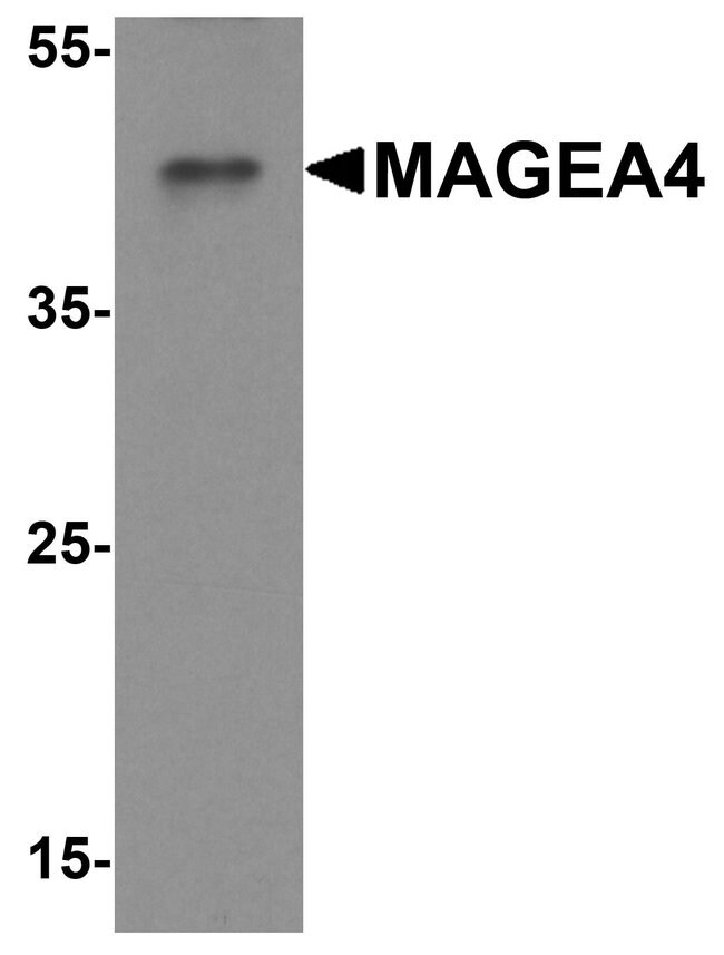 0.1MG MAGEA4 0.1 MG