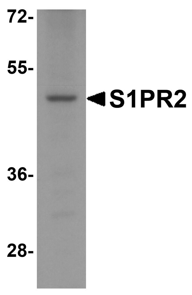 0.1MG S1PR2 0.1 MG