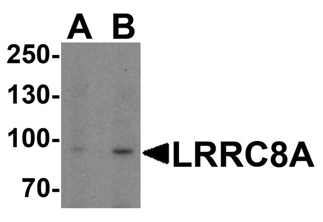 0.1MG LRRC8A 0.1 MG