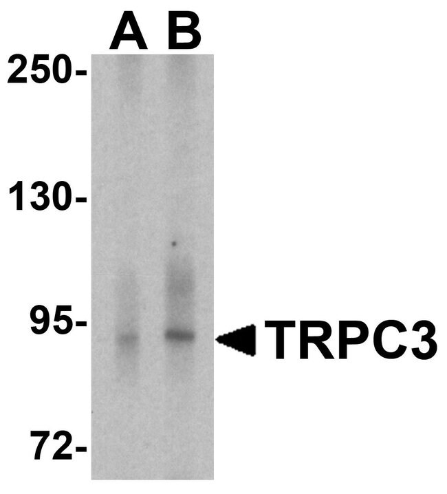 0.1MG TRPC3 0.1 MG