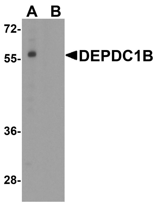 0.1MG DEPDC1B 0.1 MG