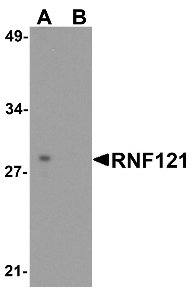 0.1MG RNF121 0.1 MG