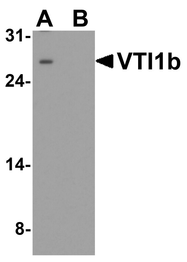 0.1MG VTI1B 0.1 MG