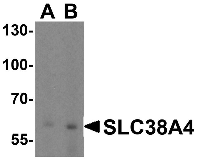 0.1MG SLC38A4 0.1 MG