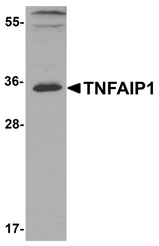 0.1MG TNFAIP1 0.1 MG