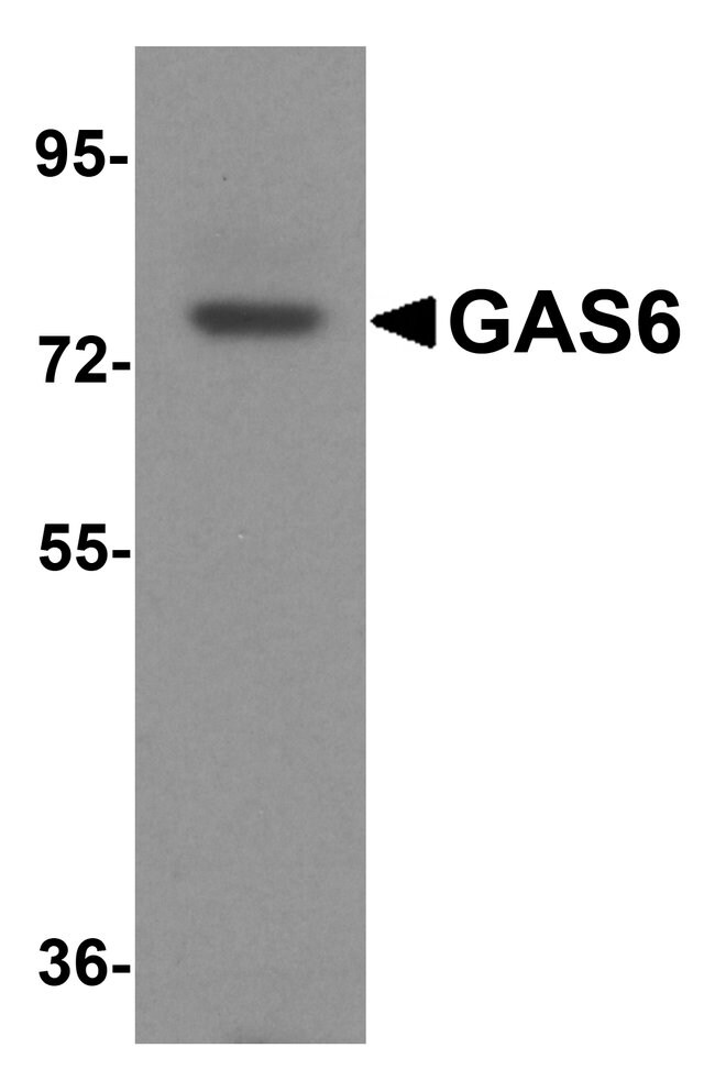 0.1MG GAS6 0.1 MG