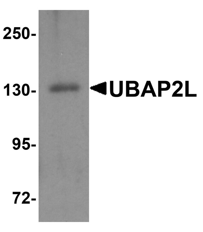 0.1MG UBAP2L 0.1 MG