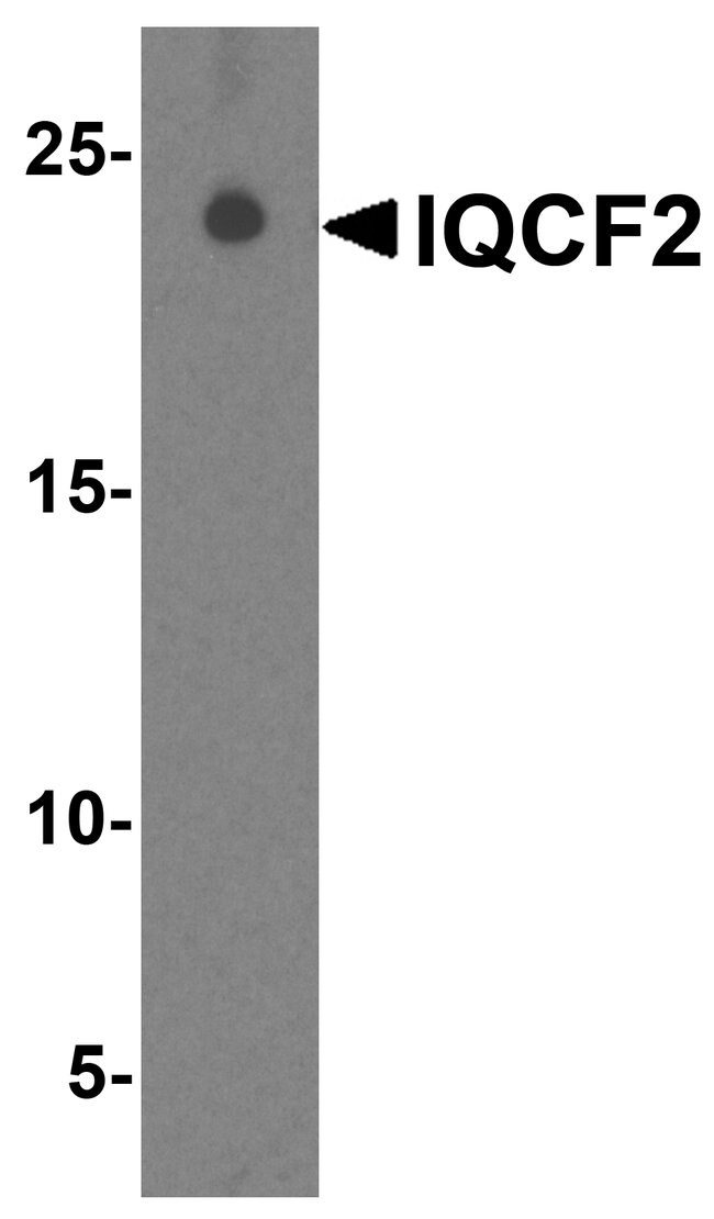 0.1MG IQCF2 0.1 MG