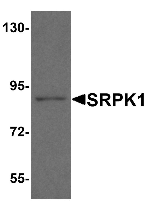 0.1MG SRPK1 0.1 MG