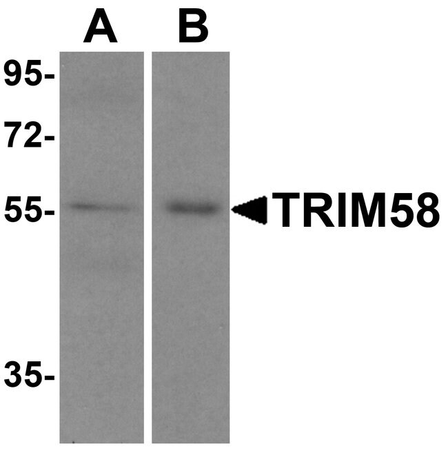 0.1MG TRIM58 0.1 MG