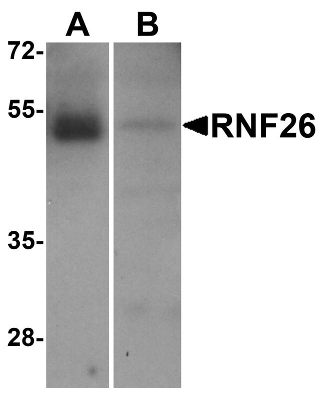 0.1MG RNF26 0.1 MG