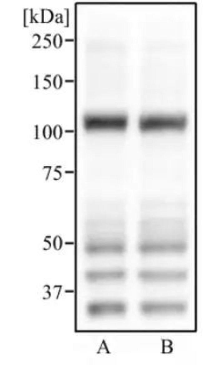 0.1ML ABCG1 0.1 ML