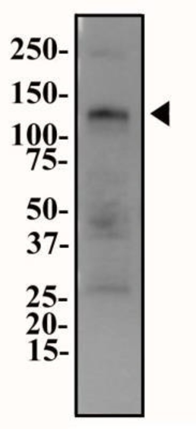 0.1ML ENPP1 0.1 ML