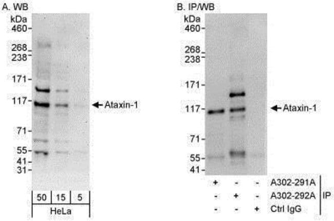 0.1ML ATAXIN 1 0.1 ML