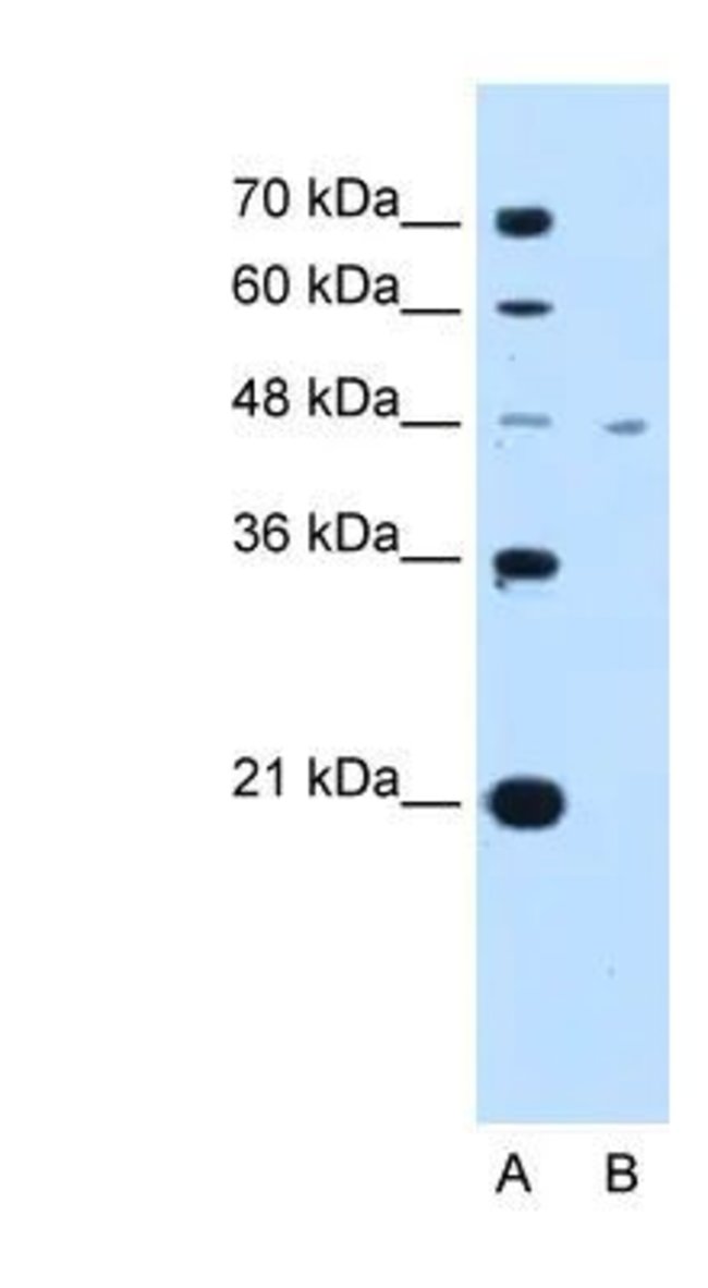 0.1MG MCT1 0.1 MG