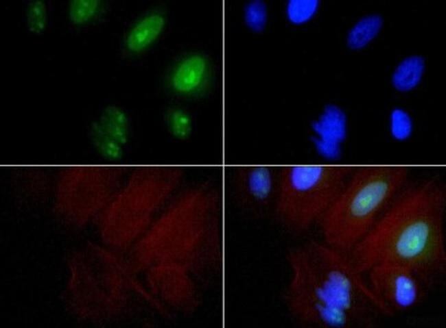 0.1ML PMSCL1 0.1 ML