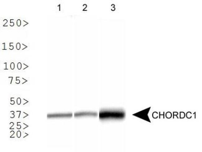 0.1ML CHORDC1 0.1 ML