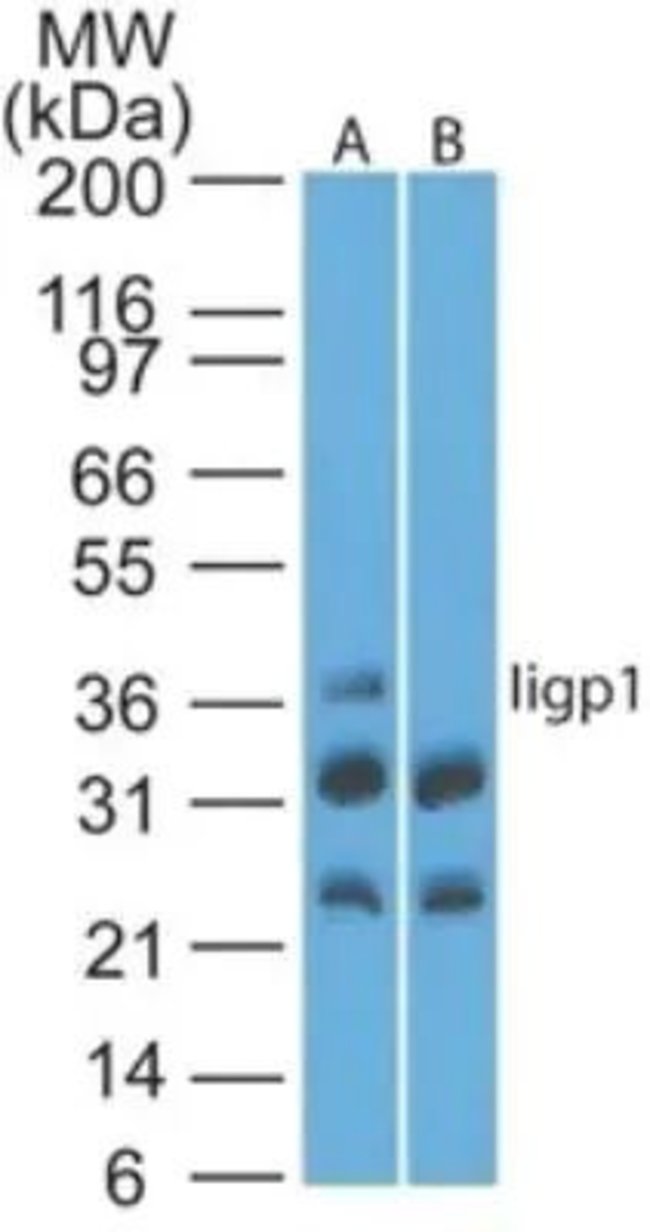 0.1MG IIGP1 0.1 MG