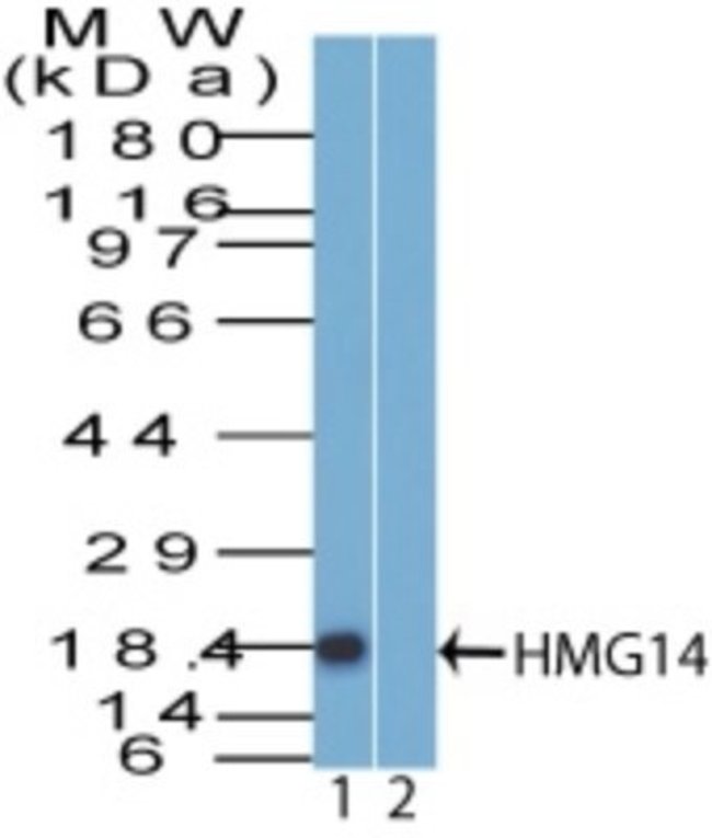 0.1MG HMGN1 0.1 MG