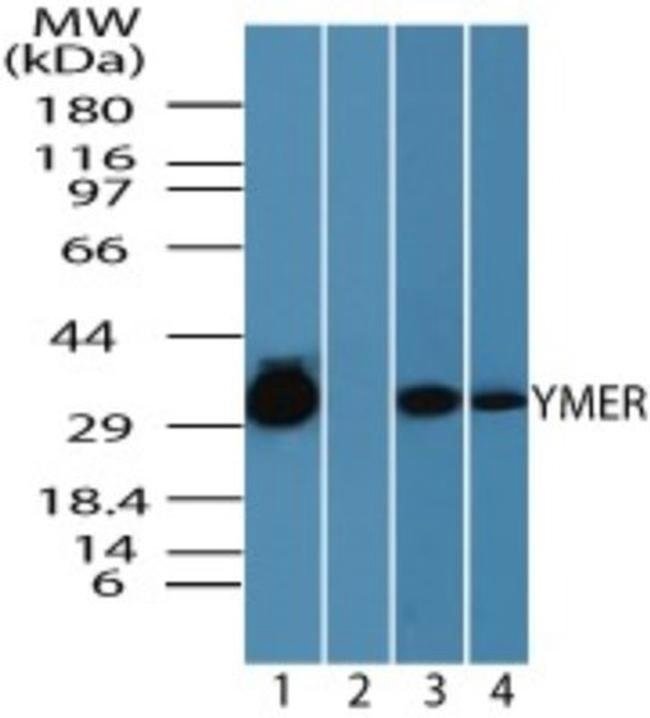 0.1MG YMER 0.1 MG