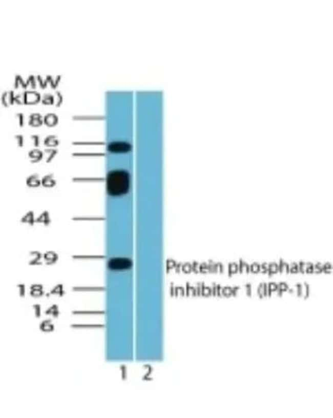 0.1MG PPP1R1A 0.1 MG