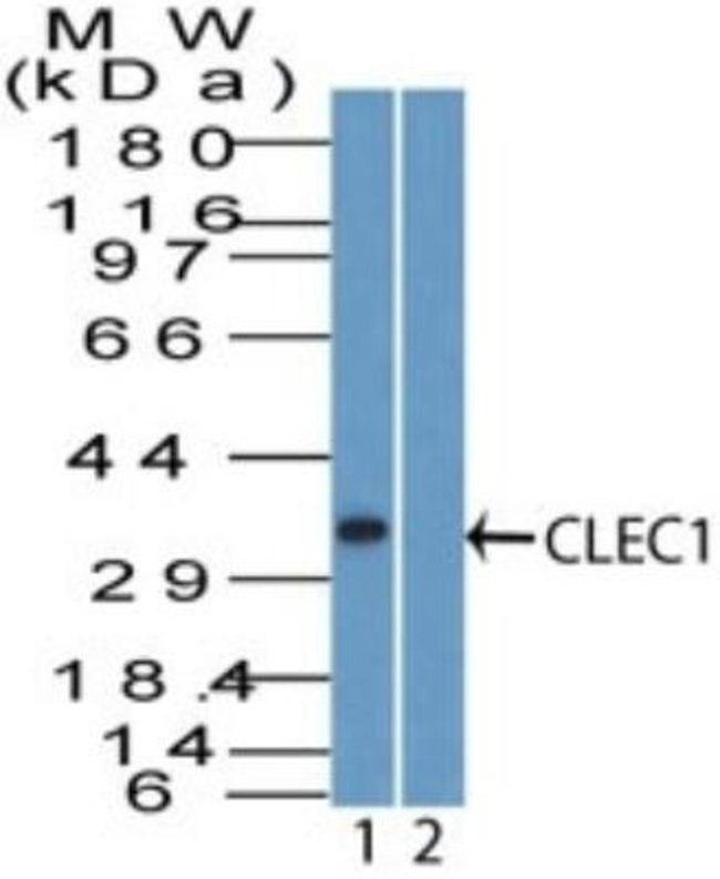 0.1MG CLEC1A 0.1 MG