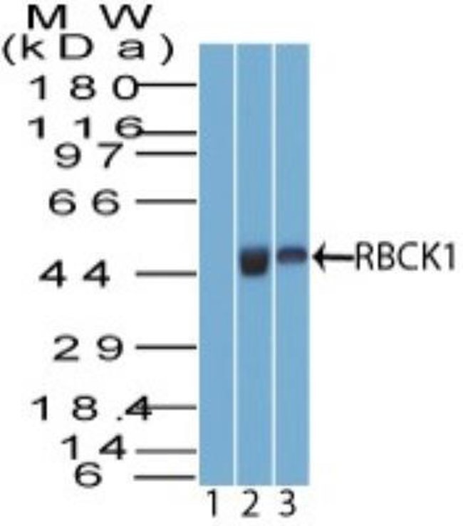 0.1MG RBCK1 0.1 MG