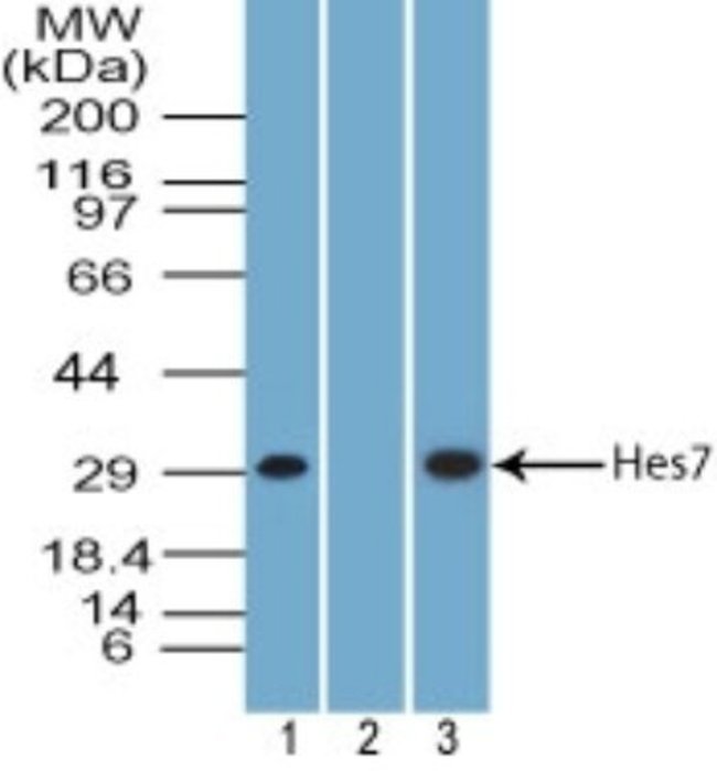 0.1MG HES7 0.1 MG