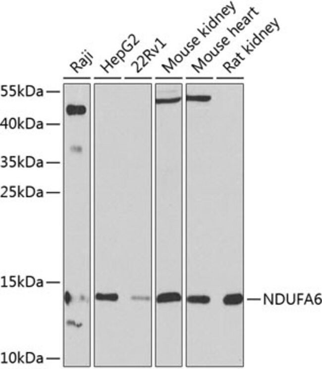 100 L NDUFA6 Polyclonal Antibody