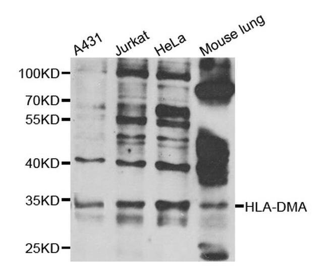 100 L HLA-DMA Polyclonal Antibody