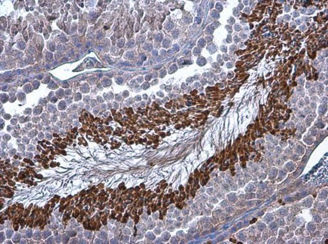 100 L Brachyury Polyclonal Antibody