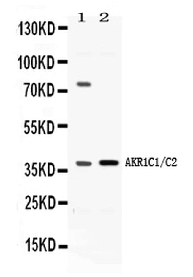 100UG AKR1C1/AKR1C2 100 UG