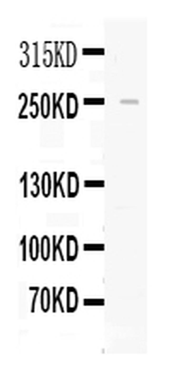 100UG APOLIPOPROTEIN B 100 UG