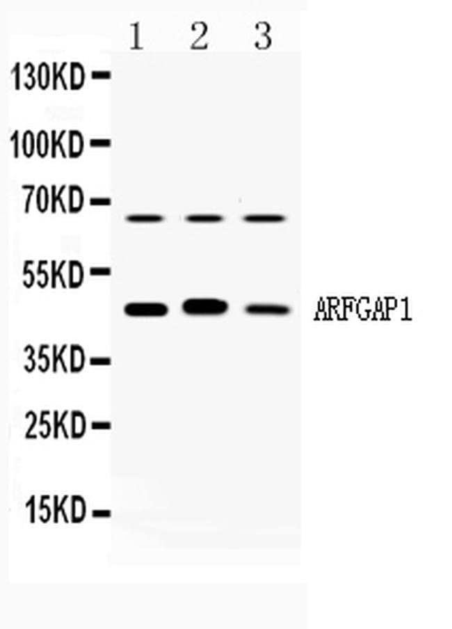 100UG ARFGAP1 100 UG