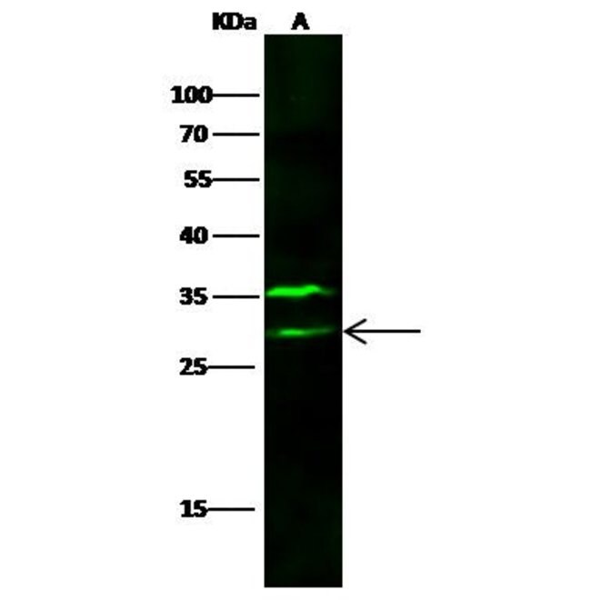 100 UL VTI1B ANTIBODY