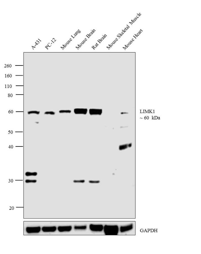 Anti-LIM Kinase 1 0.1 mg