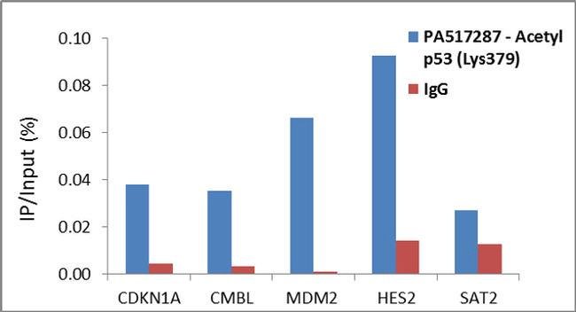 100UL ACETYL-P53 (LYS379)