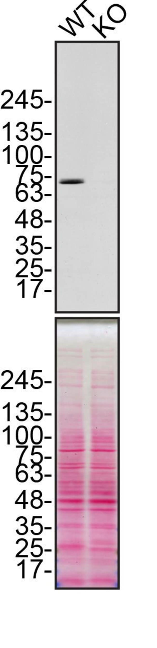 100UL CALPAIN 2 LARGE SUBUNIT (M-TYPE)