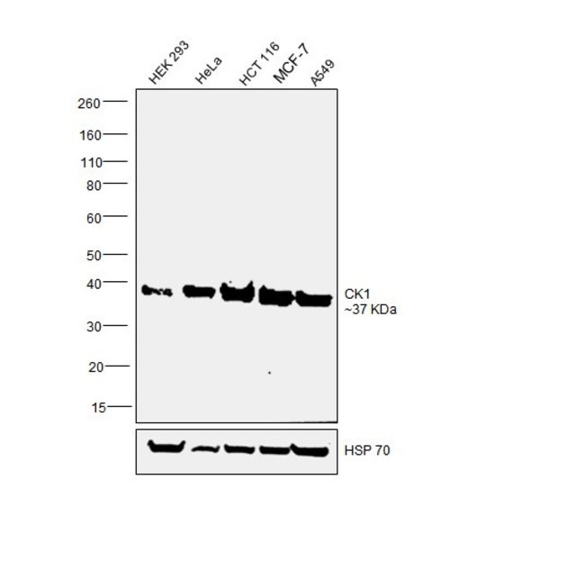 100UL ANTI-CK1 POLYCLONAL ANTIBODY