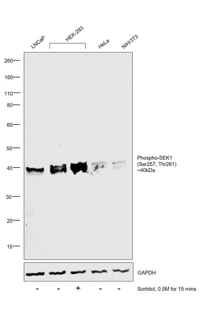 100UL PHOSPHO-SEK1/NHPK4 (SER257/THR261)