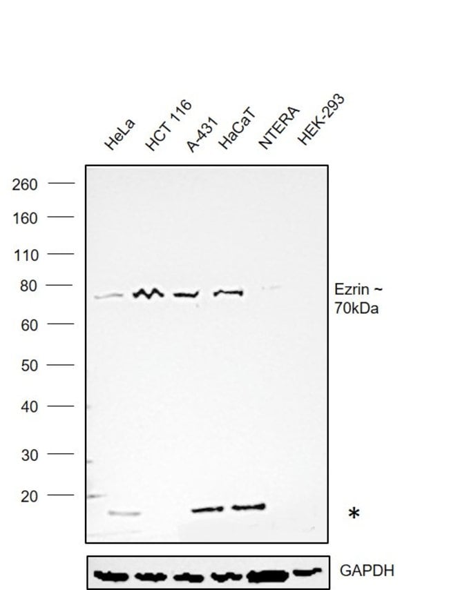 100UL EZRIN/RADIXIN/MOESIN