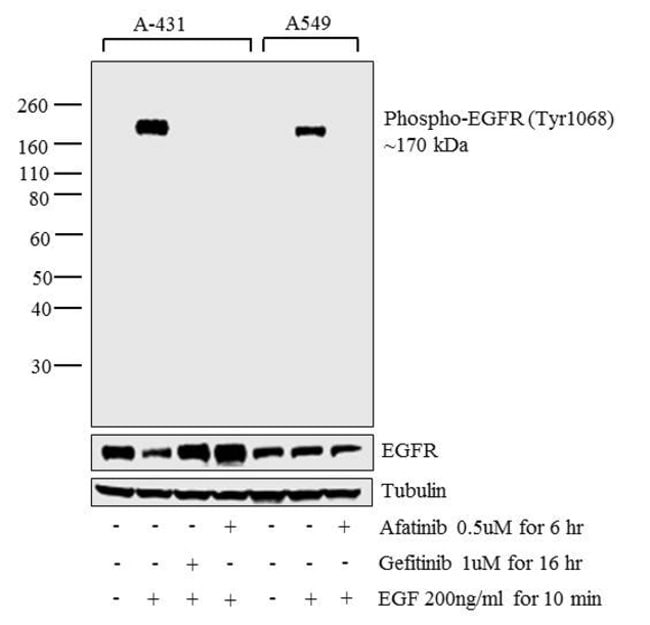 100UL PHOSPHO-EGF RECEPTOR (TYR1068)