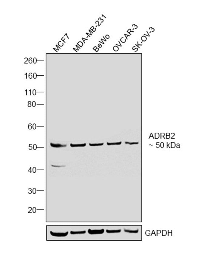 ADRB2R/ADRB2 Polyclonal Antibody 100  g