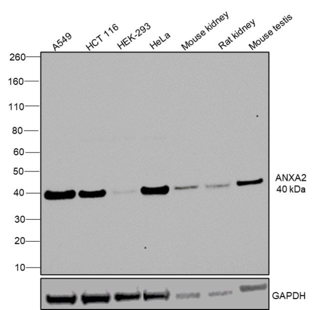 Annexin II polyclonal Antibody 100  g