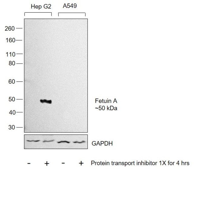 AHSG Polyclonal Antibody, 100  g