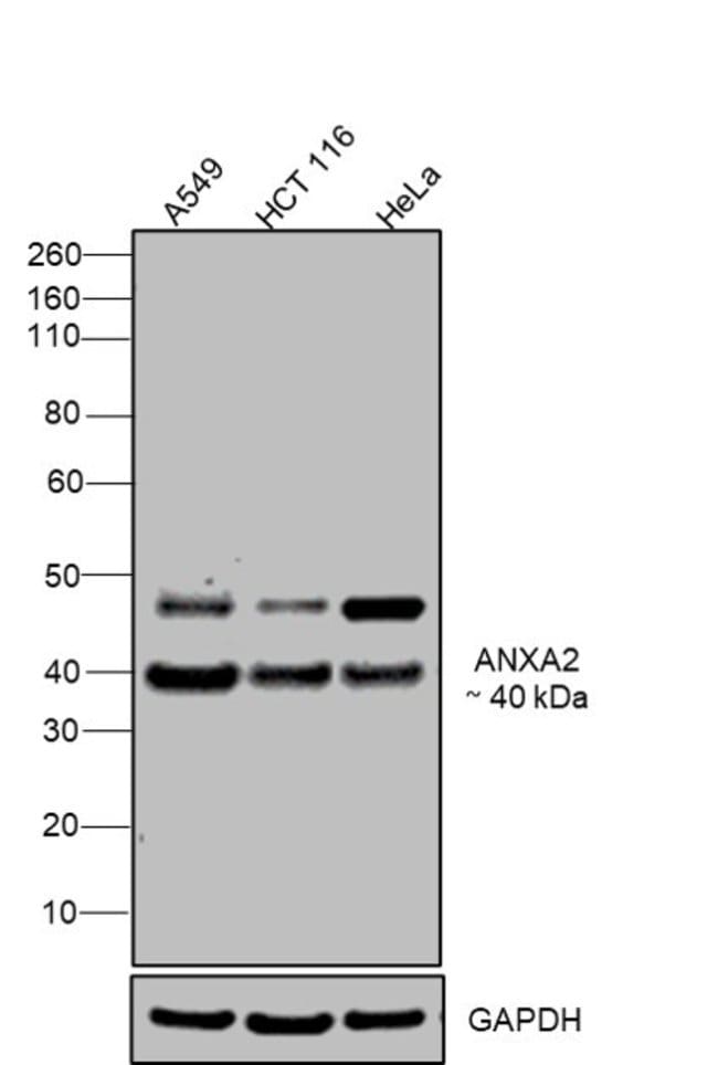 ANTI-ANNEXIN II