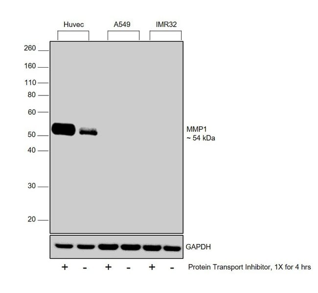 ANTI-MMP1